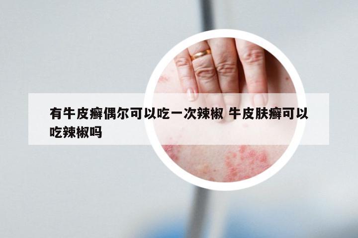 有牛皮癣偶尔可以吃一次辣椒 牛皮肤癣可以吃辣椒吗