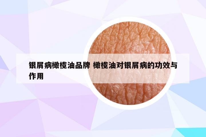 银屑病橄榄油品牌 橄榄油对银屑病的功效与作用