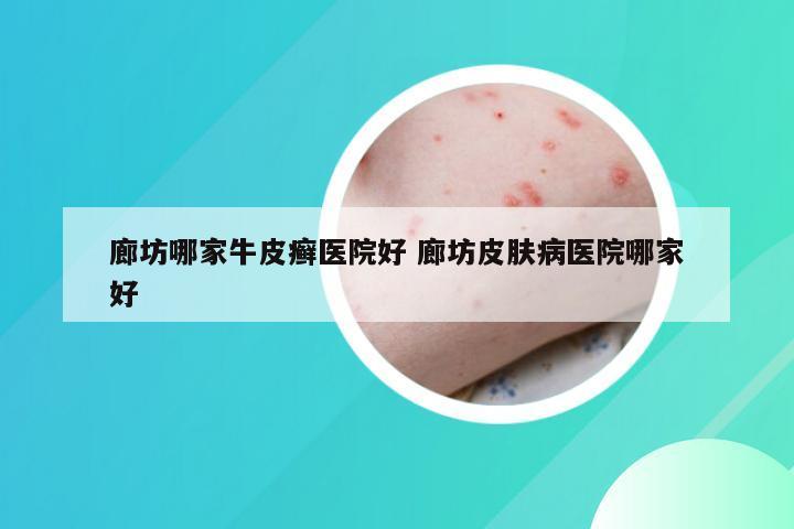 廊坊哪家牛皮癣医院好 廊坊皮肤病医院哪家好