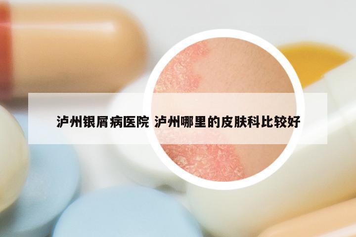 泸州银屑病医院 泸州哪里的皮肤科比较好