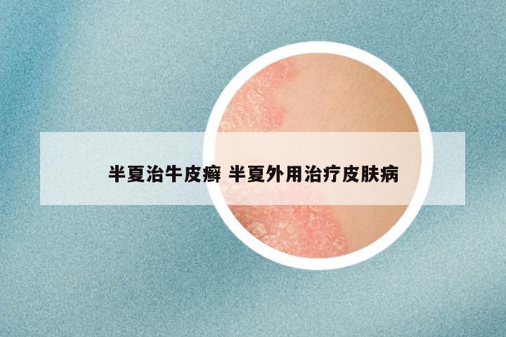 半夏治牛皮癣 半夏外用治疗皮肤病