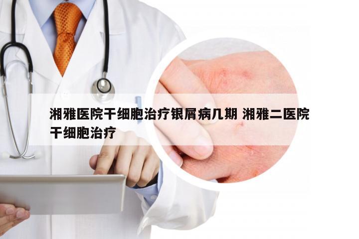 湘雅医院干细胞治疗银屑病几期 湘雅二医院干细胞治疗