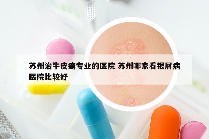 苏州治牛皮癣专业的医院 苏州哪家看银屑病医院比较好