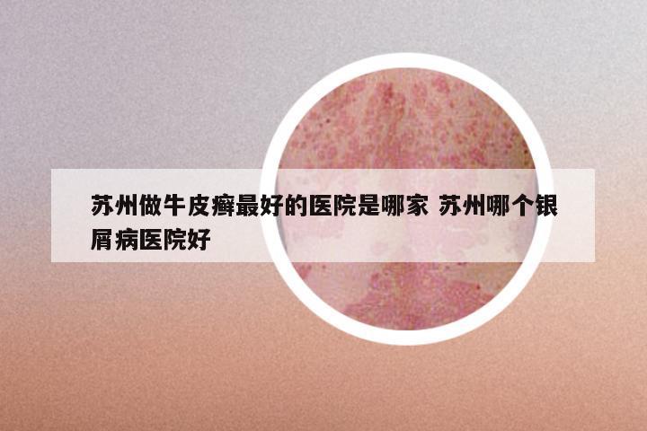苏州做牛皮癣最好的医院是哪家 苏州哪个银屑病医院好