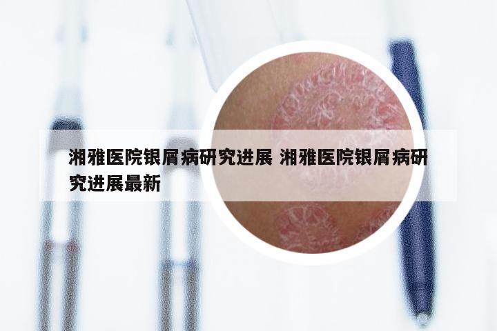 湘雅医院银屑病研究进展 湘雅医院银屑病研究进展最新