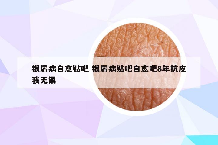 银屑病自愈贴吧 银屑病贴吧自愈吧8年抗皮我无银