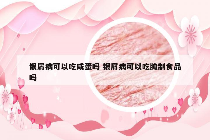 银屑病可以吃咸蛋吗 银屑病可以吃腌制食品吗