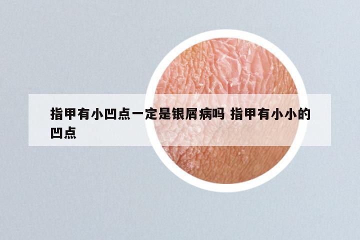 指甲有小凹点一定是银屑病吗 指甲有小小的凹点
