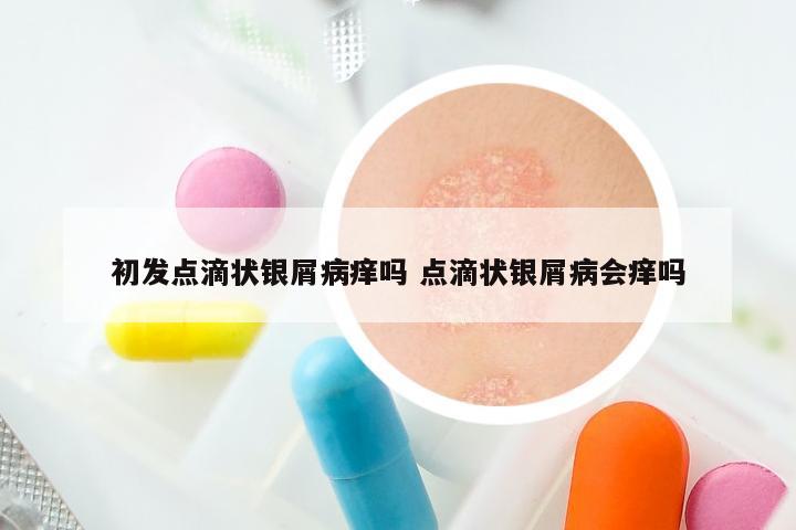 初发点滴状银屑病痒吗 点滴状银屑病会痒吗