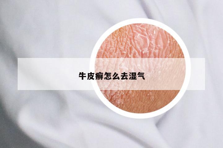 牛皮癣怎么去湿气