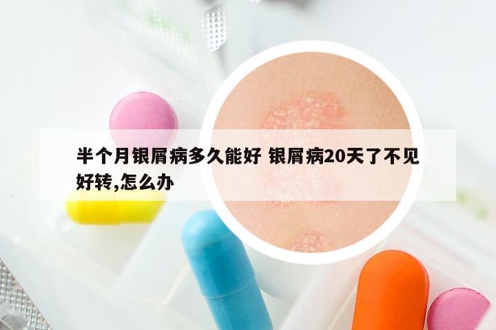 半个月银屑病多久能好 银屑病20天了不见好转,怎么办
