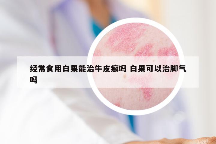 经常食用白果能治牛皮癣吗 白果可以治脚气吗