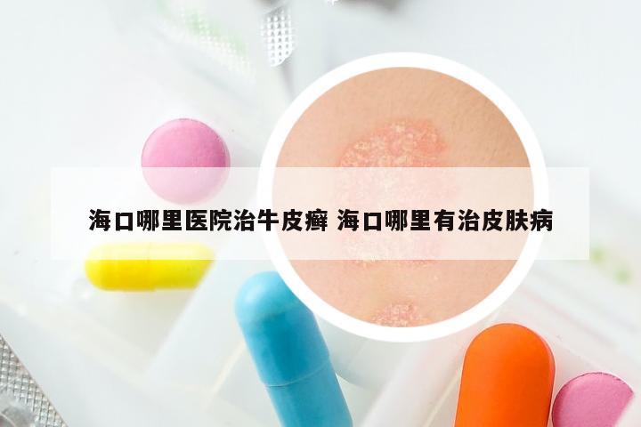 海口哪里医院治牛皮癣 海口哪里有治皮肤病