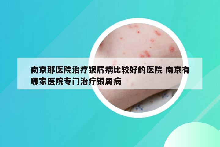 南京那医院治疗银屑病比较好的医院 南京有哪家医院专门治疗银屑病