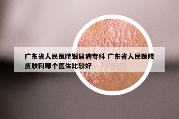 广东省人民医院银屑病专科 广东省人民医院皮肤科哪个医生比较好