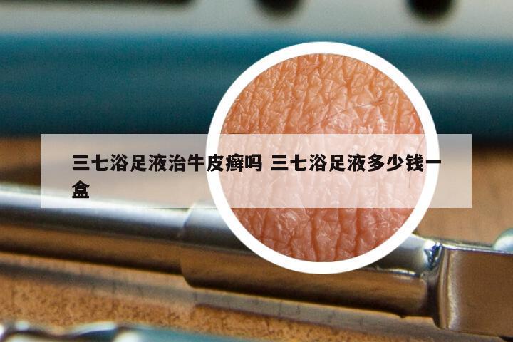 三七浴足液治牛皮癣吗 三七浴足液多少钱一盒