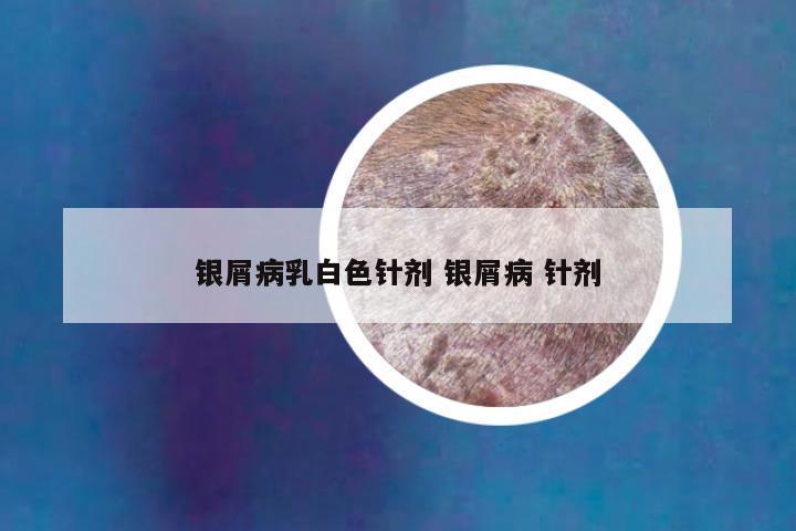 银屑病乳白色针剂 银屑病 针剂