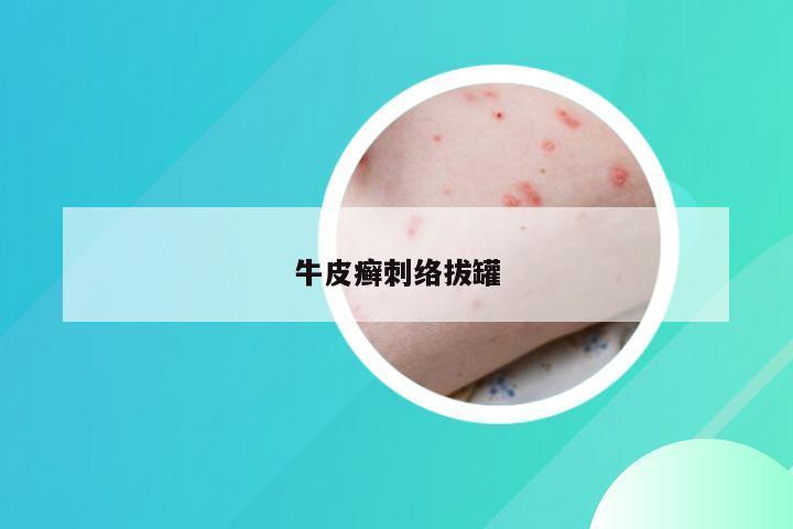 牛皮癣刺络拔罐