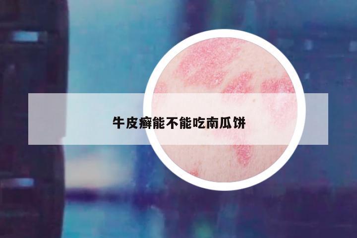 牛皮癣能不能吃南瓜饼