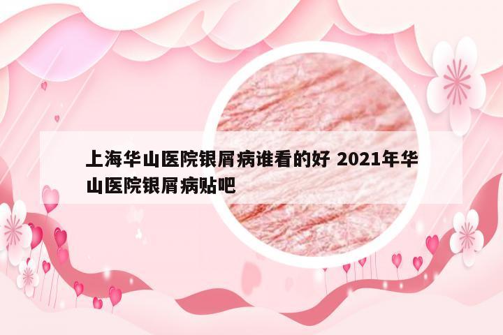 上海华山医院银屑病谁看的好 2021年华山医院银屑病贴吧