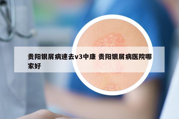 贵阳银屑病速去v3中康 贵阳银屑病医院哪家好