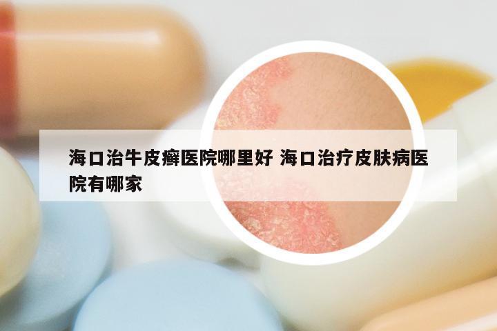 海口治牛皮癣医院哪里好 海口治疗皮肤病医院有哪家