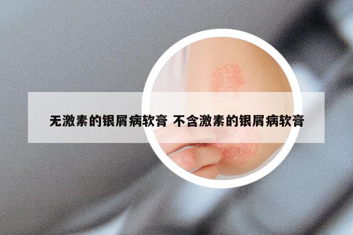 无激素的银屑病软膏 不含激素的银屑病软膏