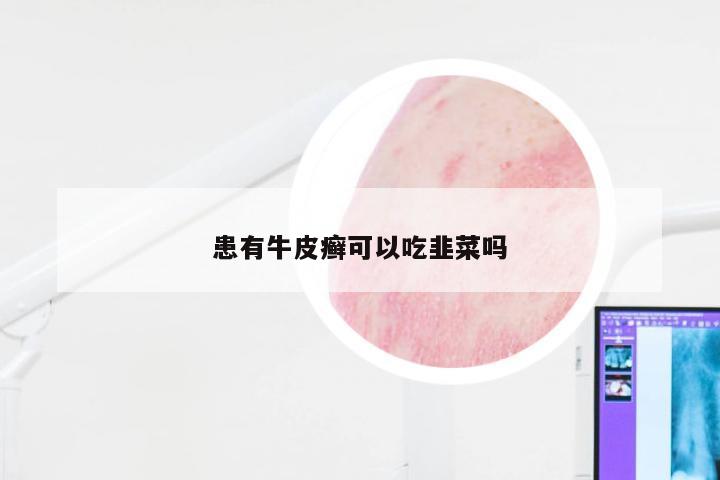 患有牛皮癣可以吃韭菜吗