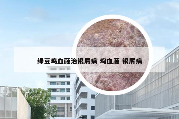 绿豆鸡血藤治银屑病 鸡血藤 银屑病