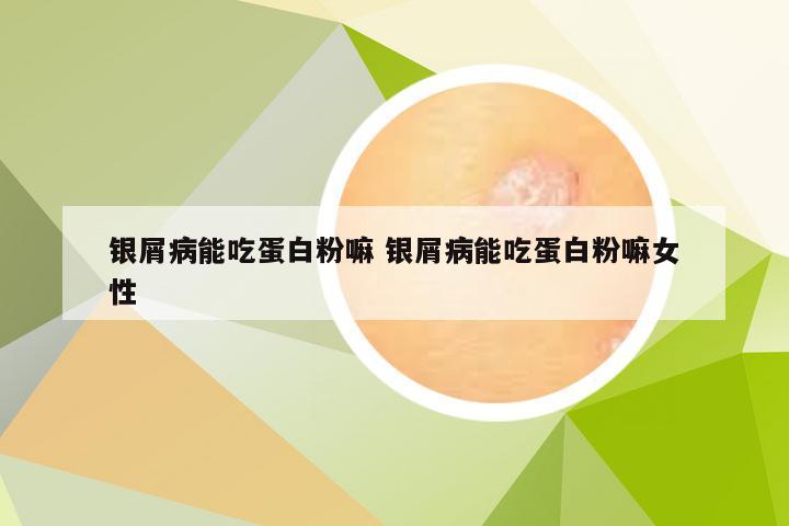银屑病能吃蛋白粉嘛 银屑病能吃蛋白粉嘛女性