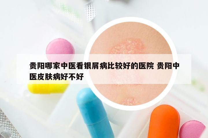 贵阳哪家中医看银屑病比较好的医院 贵阳中医皮肤病好不好
