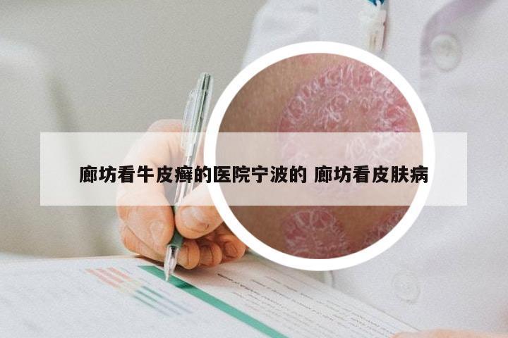 廊坊看牛皮癣的医院宁波的 廊坊看皮肤病