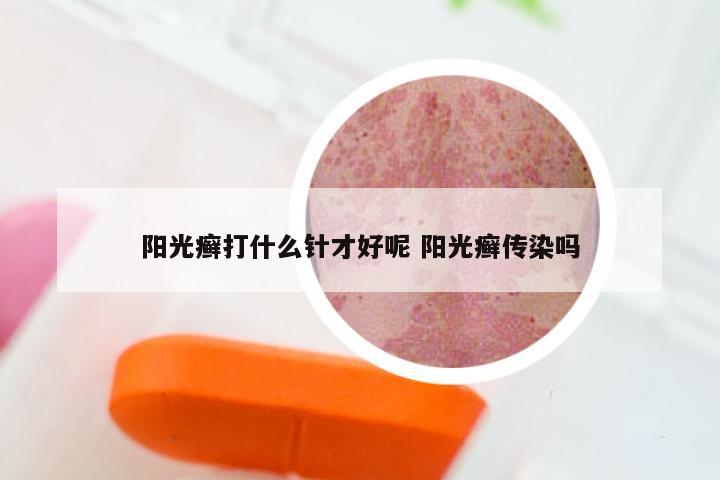 阳光癣打什么针才好呢 阳光癣传染吗