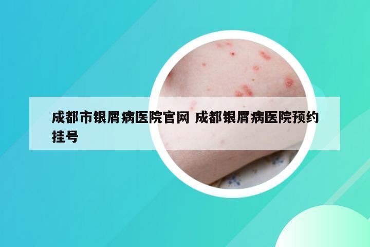成都市银屑病医院官网 成都银屑病医院预约挂号