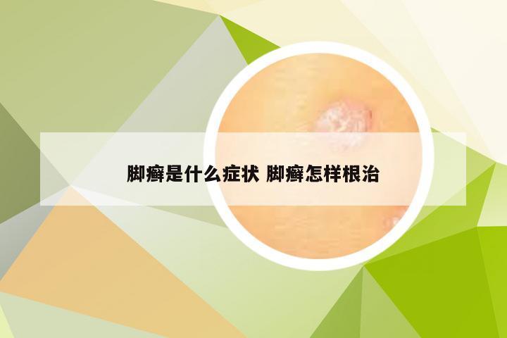 脚癣是什么症状 脚癣怎样根治