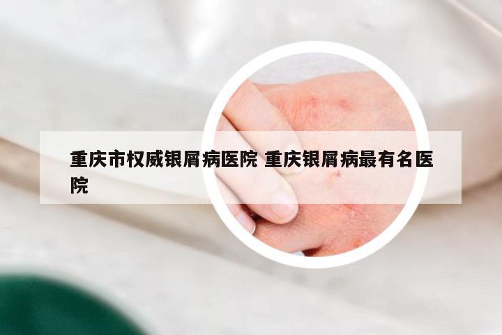 重庆市权威银屑病医院 重庆银屑病最有名医院