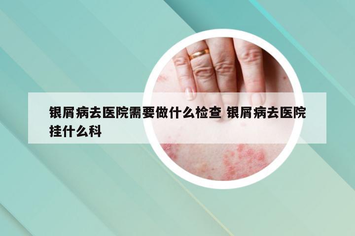 银屑病去医院需要做什么检查 银屑病去医院挂什么科