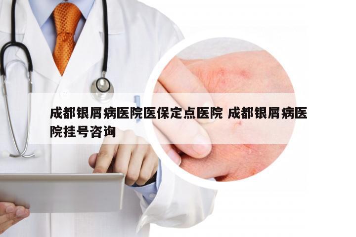 成都银屑病医院医保定点医院 成都银屑病医院挂号咨询