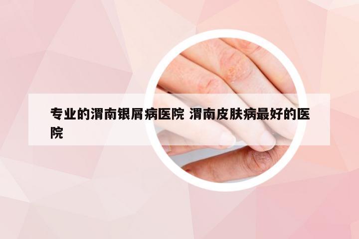 专业的渭南银屑病医院 渭南皮肤病最好的医院