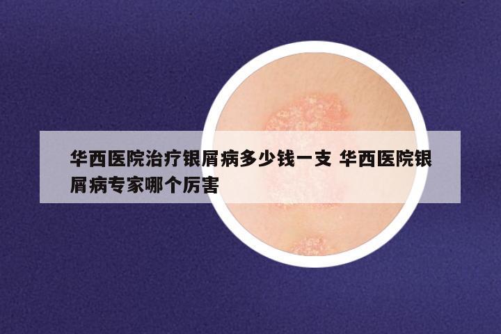 华西医院治疗银屑病多少钱一支 华西医院银屑病专家哪个厉害
