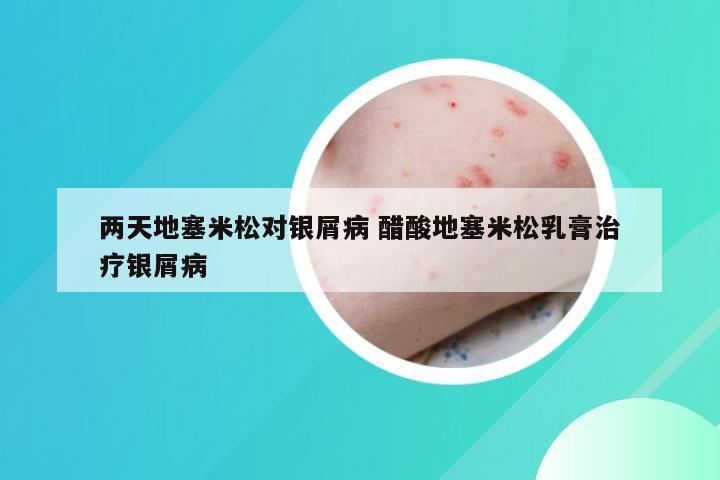 两天地塞米松对银屑病 醋酸地塞米松乳膏治疗银屑病