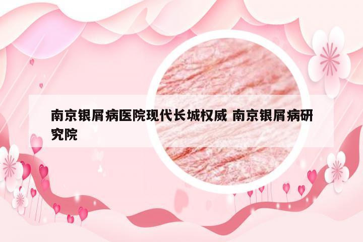 南京银屑病医院现代长城权威 南京银屑病研究院