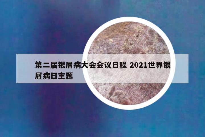 第二届银屑病大会会议日程 2021世界银屑病日主题