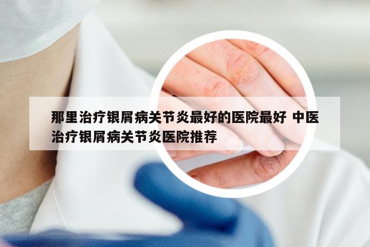 那里治疗银屑病关节炎最好的医院最好 中医治疗银屑病关节炎医院推荐
