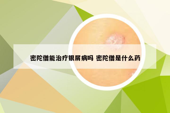密陀僧能治疗银屑病吗 密陀僧是什么药