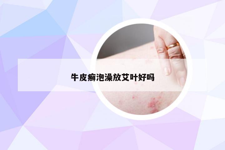牛皮癣泡澡放艾叶好吗