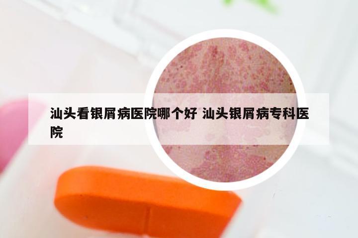 汕头看银屑病医院哪个好 汕头银屑病专科医院