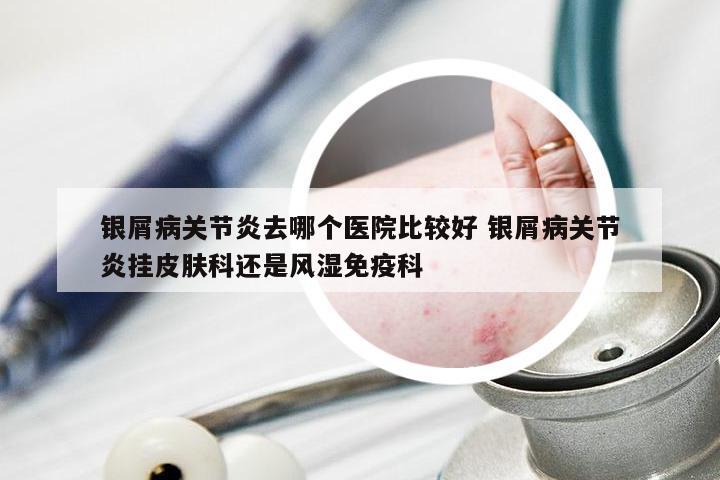 银屑病关节炎去哪个医院比较好 银屑病关节炎挂皮肤科还是风湿免疫科