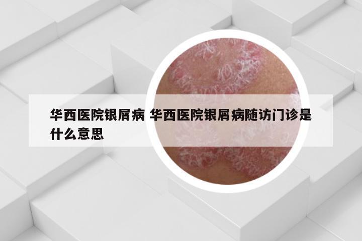 华西医院银屑病 华西医院银屑病随访门诊是什么意思