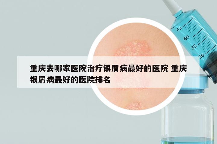 重庆去哪家医院治疗银屑病最好的医院 重庆银屑病最好的医院排名